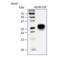 rhGM-CSF, гранулоцитарно-макрофагальный колониестимулирующий фактор человека, рекомбинантный белок, 2 мкг