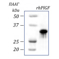 rhPlGF, плацентарный фактор роста человека, рекомбинантный белок, 2 мкг