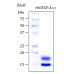 rhVEGF-A121 фактор роста эндотелия сосудов- А человека, изоформа 121, рекомбинантный белок, 10 мкг