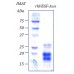 rhVEGF-A189 фактор роста эндотелия сосудов- А человека, изоформа 189, рекомбинантный белок, 10 мкг
